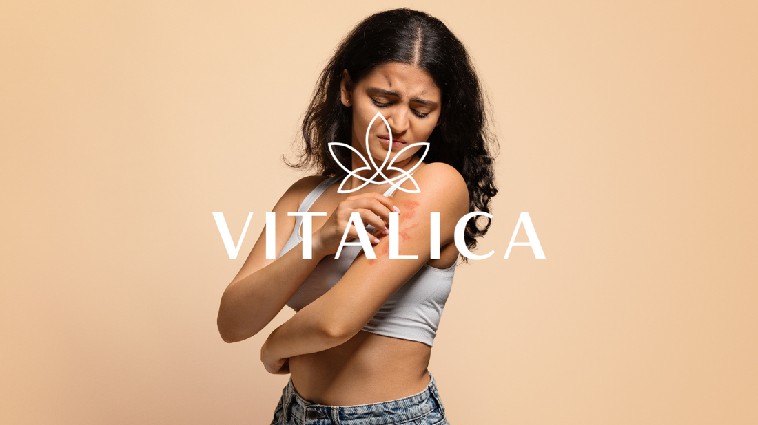 Псориазис, екзема и дерматит: Какво ги причинява и как да се грижим за кожата си по естествен начин