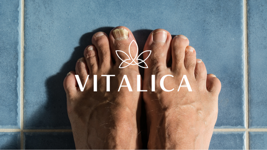 Гъбички по кожата и ноктите: Причини, симптоми и как да се справим по естествен път